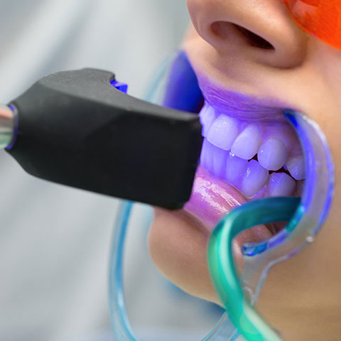 cosmetic dentistry